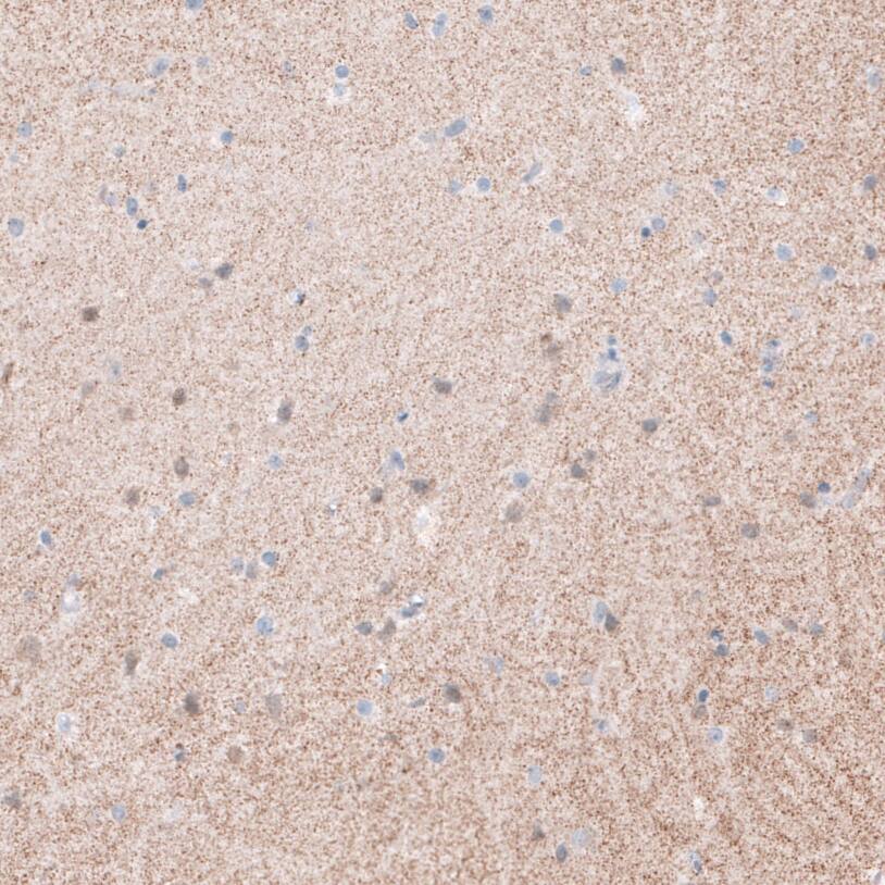 Synaptopodin Antibody - BSA Free Immunohistochemistry-Paraffin: Synaptopodin Antibody - BSA Free [NBP1-87887]