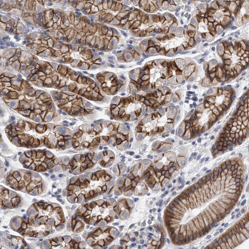 PEPP3 Antibody - BSA Free Immunohistochemistry-Paraffin: PEPP3 Antibody - BSA Free [NBP1-87889]