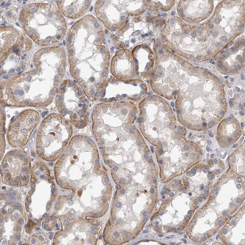 PEPP3 Antibody - BSA Free Immunohistochemistry-Paraffin: PEPP3 Antibody - BSA Free [NBP1-87889]