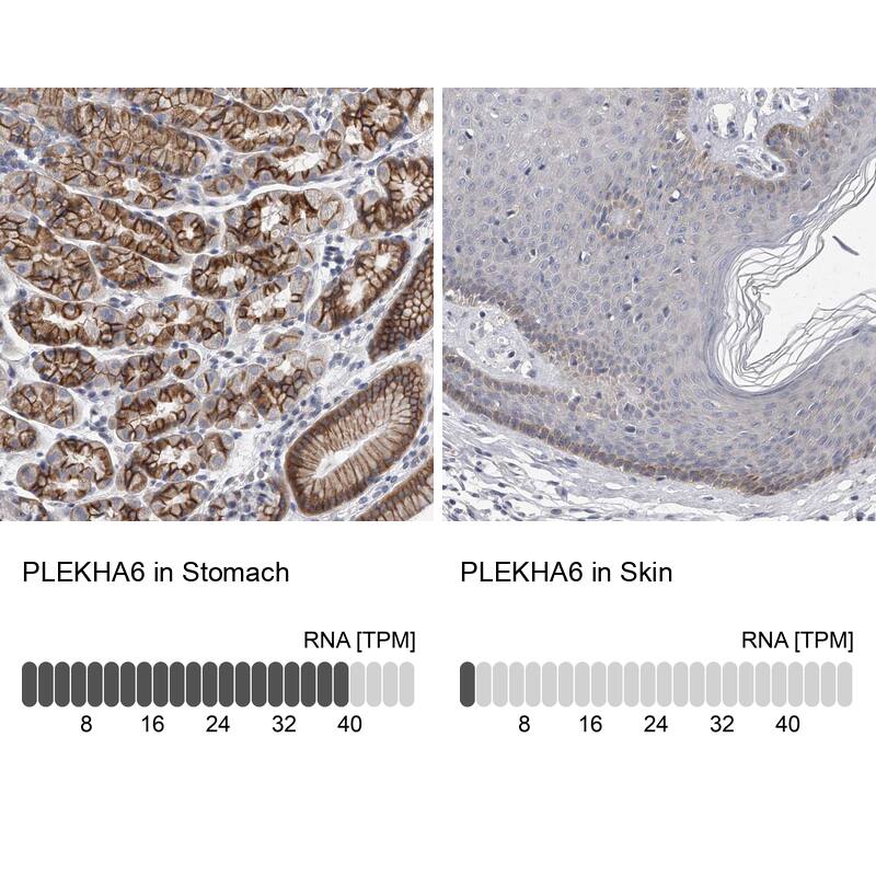 PEPP3 Antibody - BSA Free Immunohistochemistry-Paraffin: PEPP3 Antibody - BSA Free [NBP1-87889]
