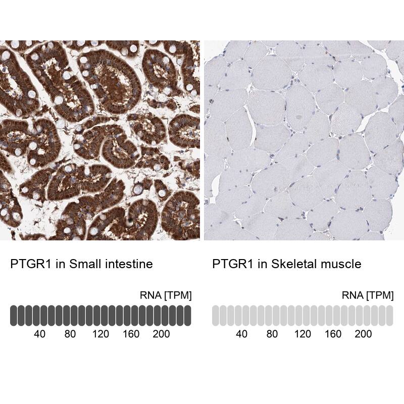 PGR1 Antibody - BSA Free Immunohistochemistry-Paraffin: PGR1 Antibody - BSA Free [NBP1-87892]