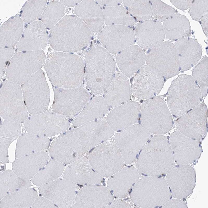 PGR1 Antibody - BSA Free Immunohistochemistry-Paraffin: PGR1 Antibody - BSA Free [NBP1-87892]