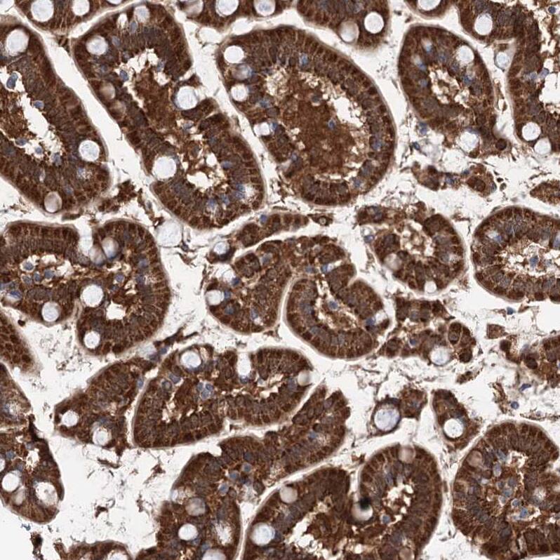 PGR1 Antibody - BSA Free Immunohistochemistry-Paraffin: PGR1 Antibody - BSA Free [NBP1-87892]