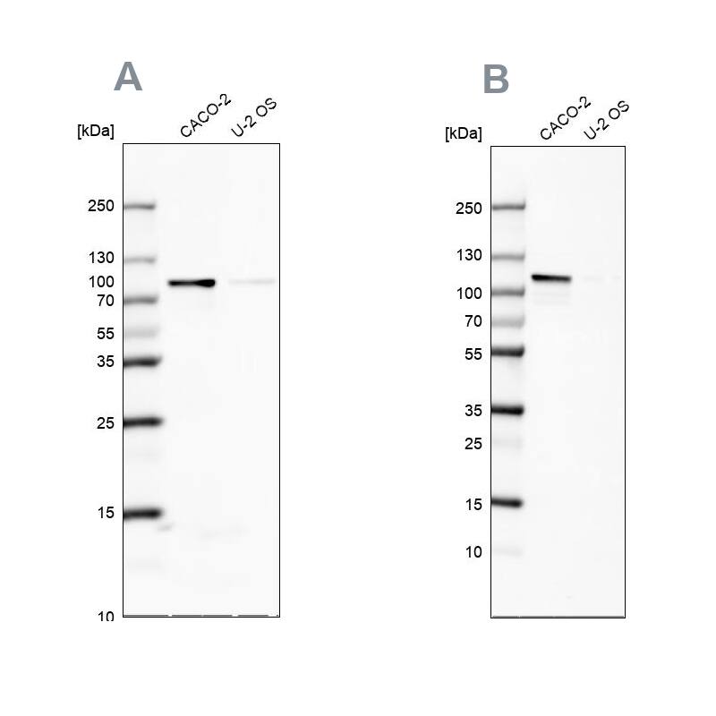 LARP5 Antibody - BSA Free Western Blot: LARP5 Antibody - BSA Free [NBP1-87902]