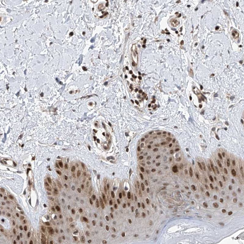 DjC9 Antibody - BSA Free Immunohistochemistry-Paraffin: DjC9 Antibody - BSA Free [NBP1-87903]