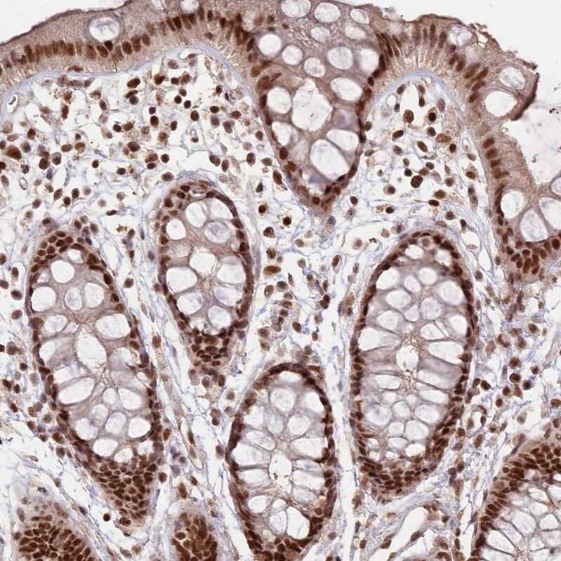 SCC112 Antibody - BSA Free Immunohistochemistry-Paraffin: SCC112 Antibody - BSA Free [NBP1-87904]