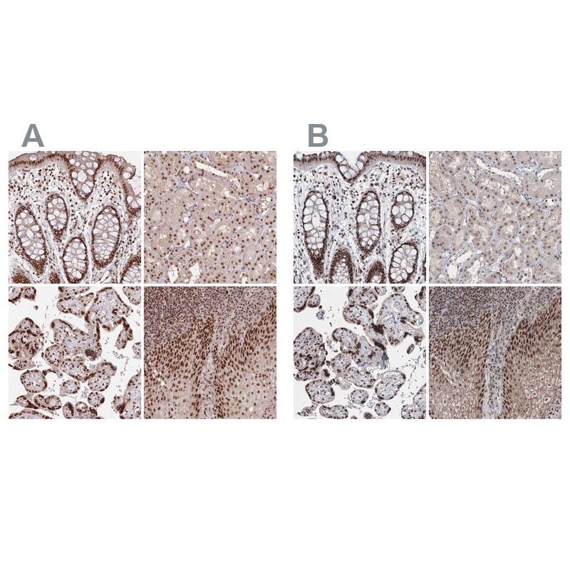 SCC112 Antibody - BSA Free Immunohistochemistry-Paraffin: SCC112 Antibody - BSA Free [NBP1-87904]