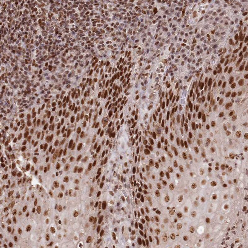 SCC112 Antibody - BSA Free Immunohistochemistry-Paraffin: SCC112 Antibody - BSA Free [NBP1-87904]