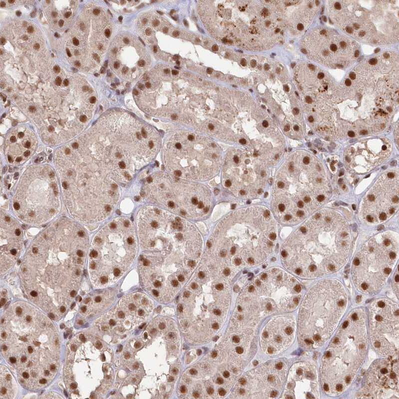 SCC112 Antibody - BSA Free Immunohistochemistry-Paraffin: SCC112 Antibody - BSA Free [NBP1-87904]