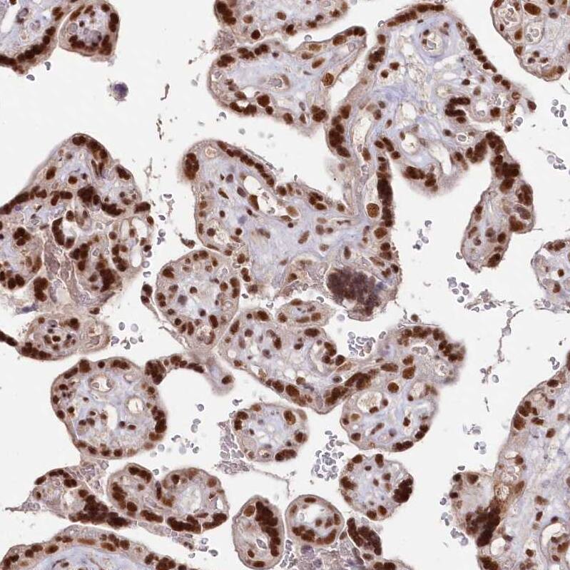 SCC112 Antibody - BSA Free Immunohistochemistry-Paraffin: SCC112 Antibody - BSA Free [NBP1-87904]