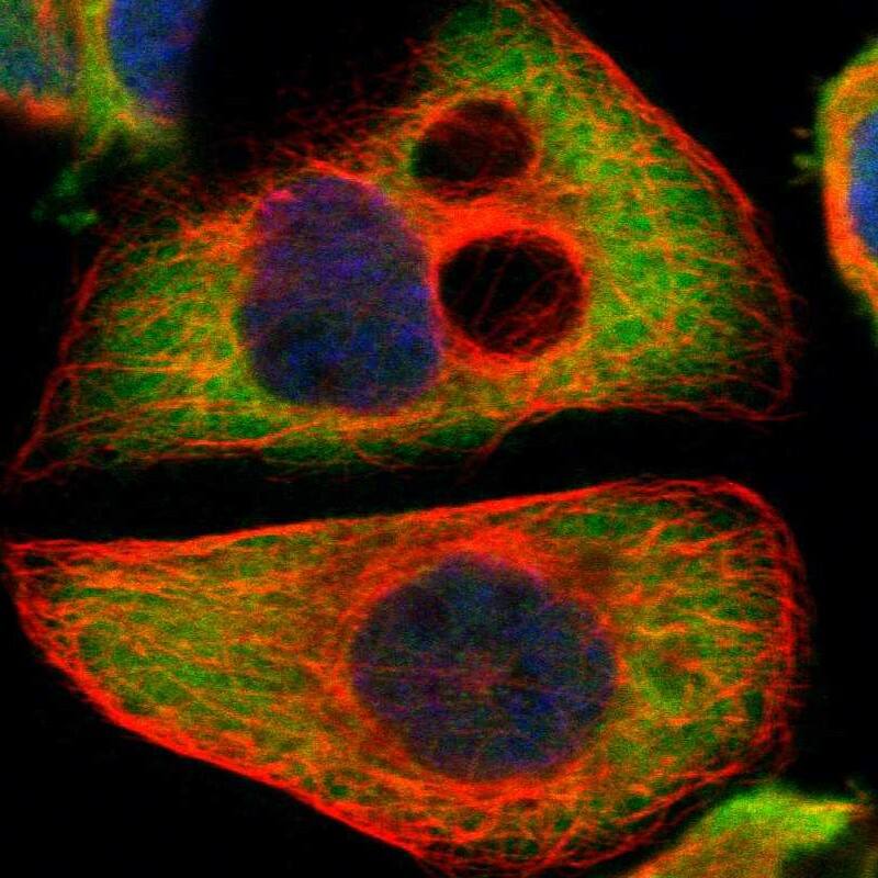 PI 4 Kinase type 2 beta Antibody - BSA Free Immunocytochemistry/ Immunofluorescence: PI 4 Kinase type 2 beta Antibody - BSA Free [NBP1-87908]