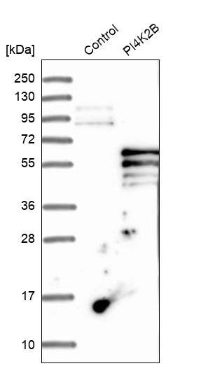 PI 4 Kinase type 2 beta Antibody - BSA Free Western Blot: PI 4 Kinase type 2 beta Antibody - BSA Free [NBP1-87908]
