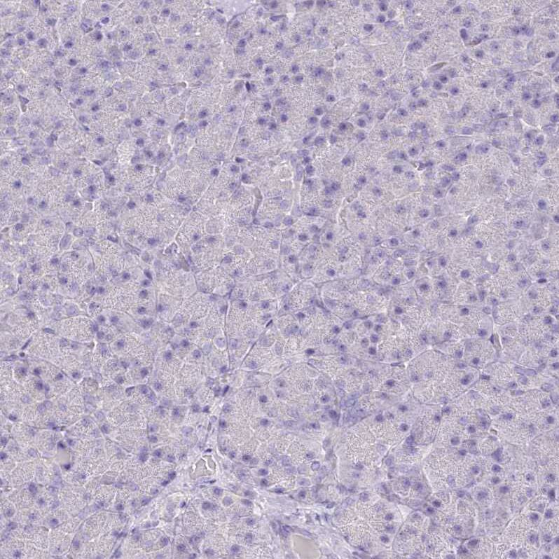 FLJ10808 Antibody - BSA Free Immunohistochemistry-Paraffin: FLJ10808 Antibody - BSA Free [NBP1-87911]