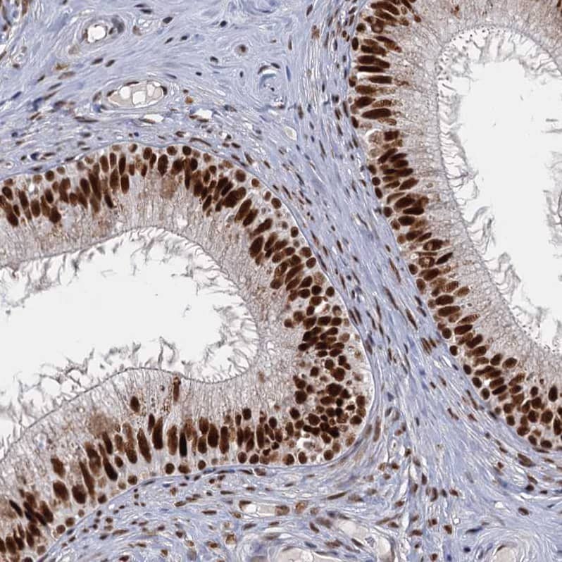P15RS Antibody - BSA Free Immunohistochemistry-Paraffin: P15RS Antibody - BSA Free [NBP1-87917]