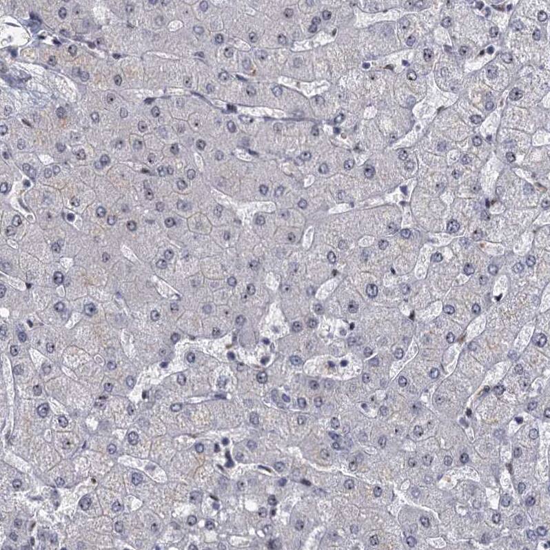 P15RS Antibody - BSA Free Immunohistochemistry-Paraffin: P15RS Antibody - BSA Free [NBP1-87917]