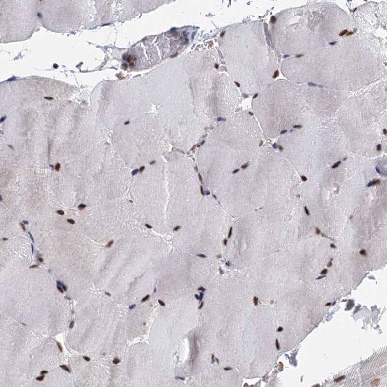 P15RS Antibody - BSA Free Immunohistochemistry-Paraffin: P15RS Antibody - BSA Free [NBP1-87917]