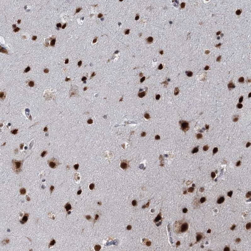 P15RS Antibody - BSA Free Immunohistochemistry-Paraffin: P15RS Antibody - BSA Free [NBP1-87917]