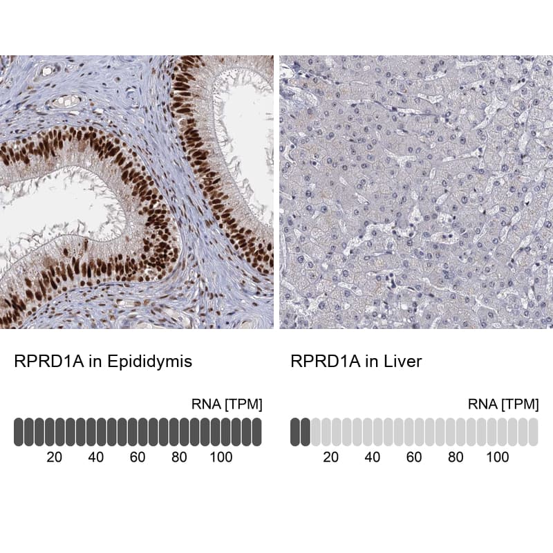 P15RS Antibody - BSA Free Immunohistochemistry-Paraffin: P15RS Antibody - BSA Free [NBP1-87917]
