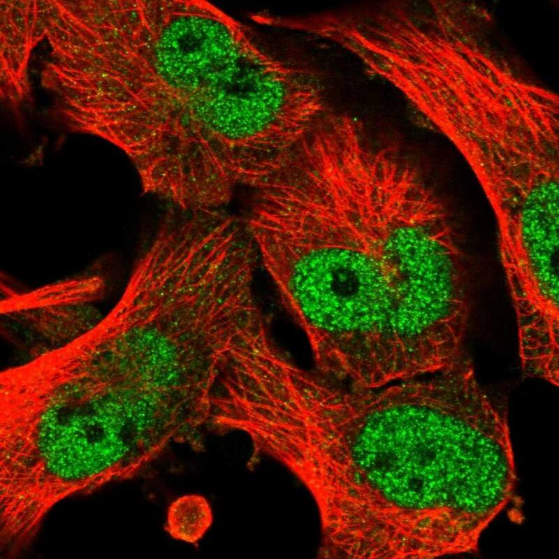 ABC2 Antibody - BSA Free Immunocytochemistry/ Immunofluorescence: ABC2 Antibody [NBP1-87918]