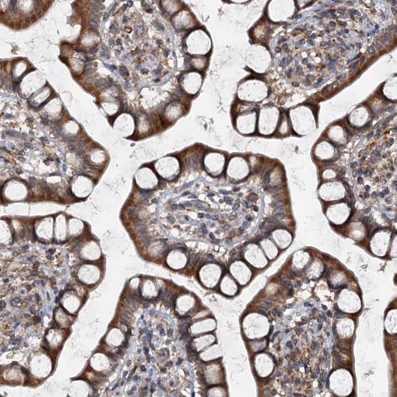 TAPBPR Antibody - BSA Free Immunohistochemistry-Paraffin: TAPBPR Antibody [NBP1-87922]
