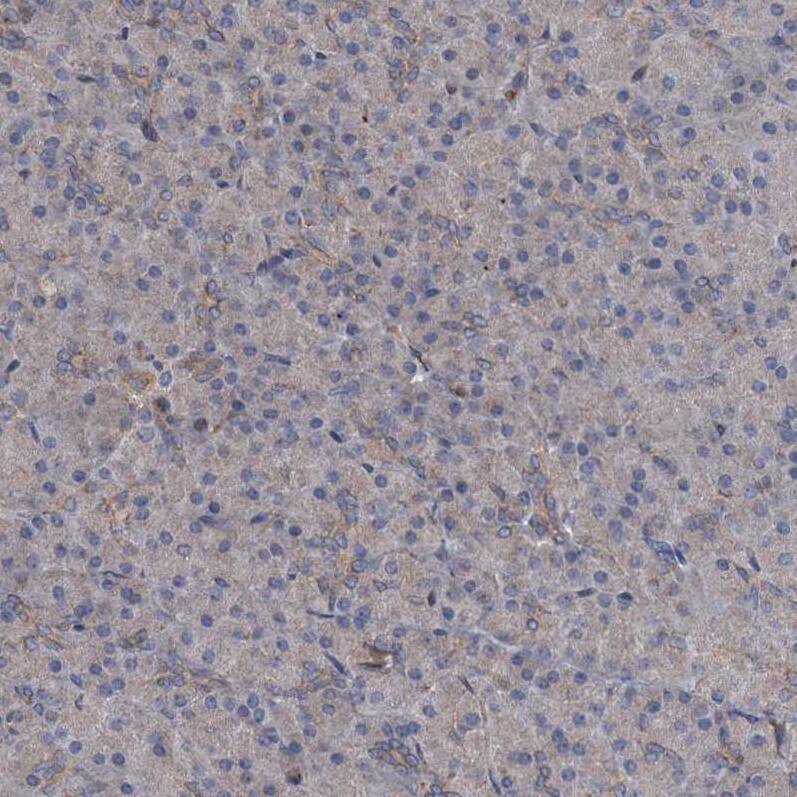 TAPBPR Antibody - BSA Free Immunohistochemistry-Paraffin: TAPBPR Antibody [NBP1-87922]