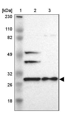 FKBP25 Antibody - BSA Free Western Blot: FKBP25 Antibody - BSA Free [NBP1-87929]