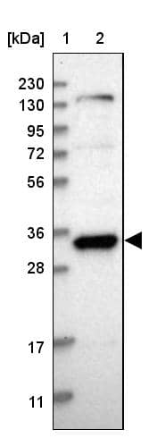 TFIIE beta Antibody - BSA Free Western Blot: TFIIE beta Antibody - BSA Free [NBP1-87931]