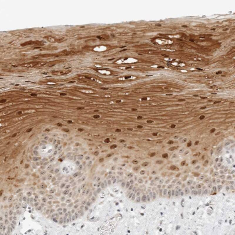 FAM80A Antibody - BSA Free Immunohistochemistry-Paraffin: FAM80A Antibody - BSA Free [NBP1-87935]