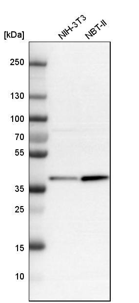 calcium homeostasis modulator 2 Antibody - BSA Free Western Blot: calcium homeostasis modulator 2 Antibody - BSA Free [NBP1-87936]