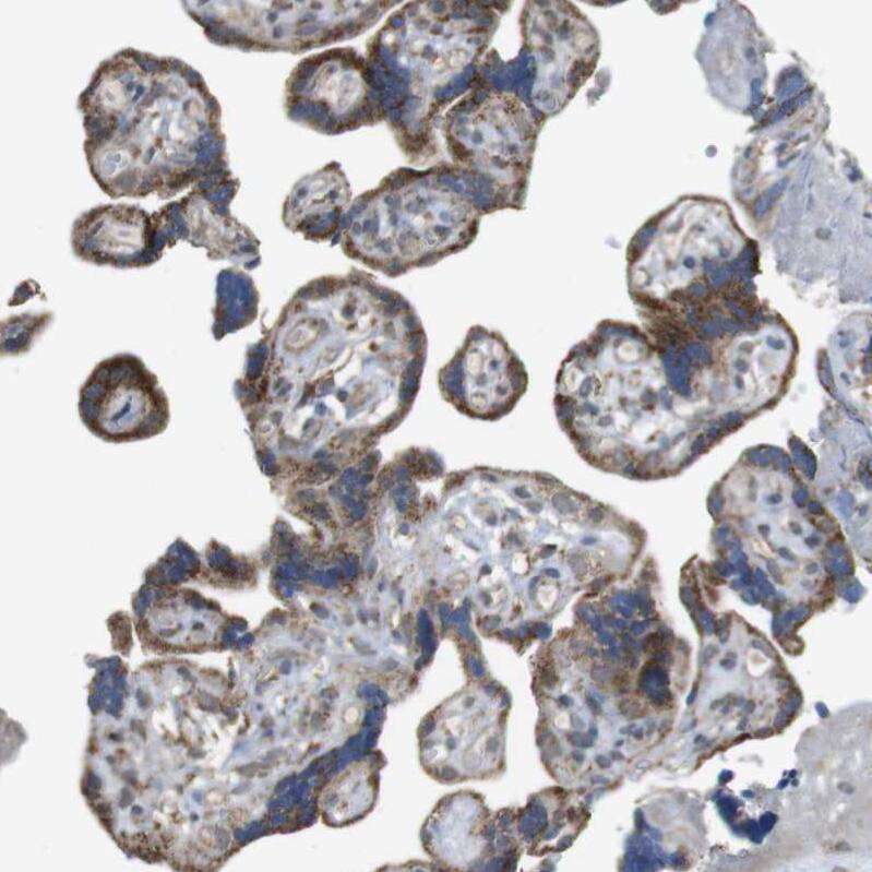 calcium homeostasis modulator 2 Antibody - BSA Free Immunohistochemistry-Paraffin: calcium homeostasis modulator 2 Antibody - BSA Free [NBP1-87936]