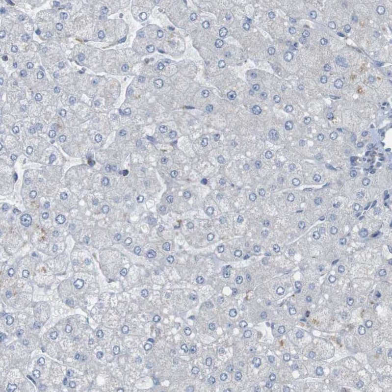 calcium homeostasis modulator 2 Antibody - BSA Free Immunohistochemistry-Paraffin: calcium homeostasis modulator 2 Antibody - BSA Free [NBP1-87936]