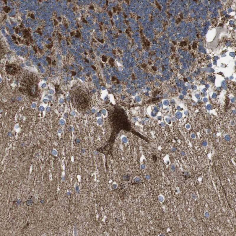 calcium homeostasis modulator 2 Antibody - BSA Free Immunohistochemistry-Paraffin: calcium homeostasis modulator 2 Antibody - BSA Free [NBP1-87936]