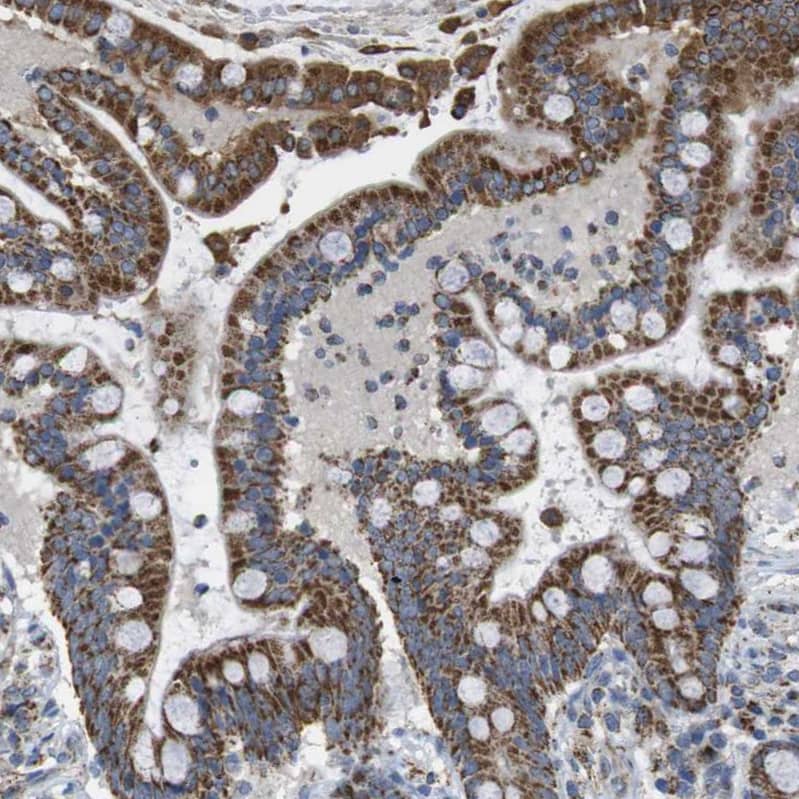 calcium homeostasis modulator 2 Antibody - BSA Free Immunohistochemistry-Paraffin: calcium homeostasis modulator 2 Antibody - BSA Free [NBP1-87936]