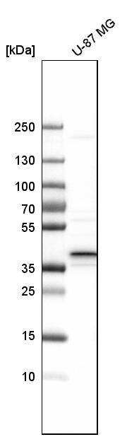 calcium homeostasis modulator 2 Antibody - BSA Free Western Blot: calcium homeostasis modulator 2 Antibody - BSA Free [NBP1-87936]