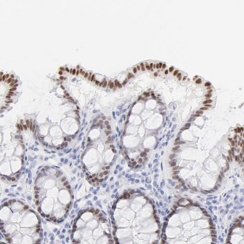 ELF3/ESE-1 Antibody - BSA Free Immunohistochemistry-Paraffin: ELF3/ESE-1 Antibody - BSA Free [NBP1-87945]