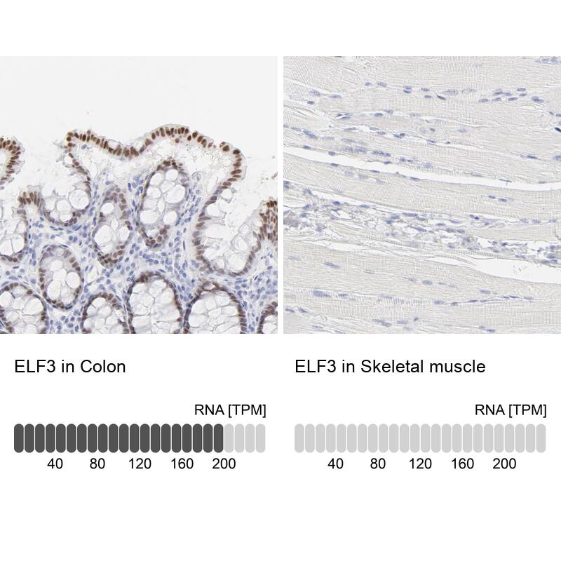 ELF3/ESE-1 Antibody - BSA Free Immunohistochemistry-Paraffin: ELF3/ESE-1 Antibody - BSA Free [NBP1-87945]