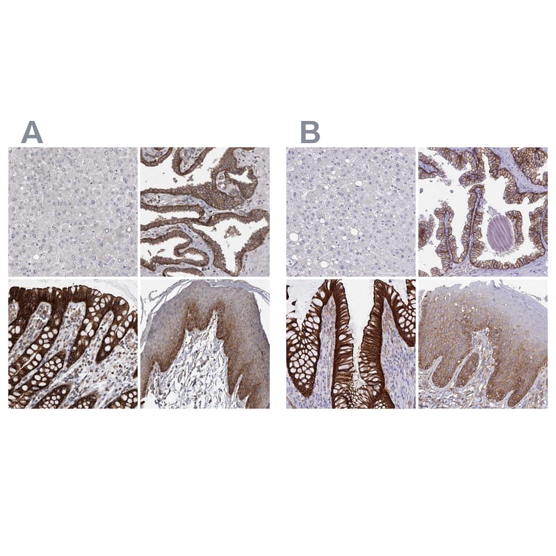 EPLIN Antibody - BSA Free Immunohistochemistry-Paraffin: EPLIN Antibody - BSA Free [NBP1-87947]