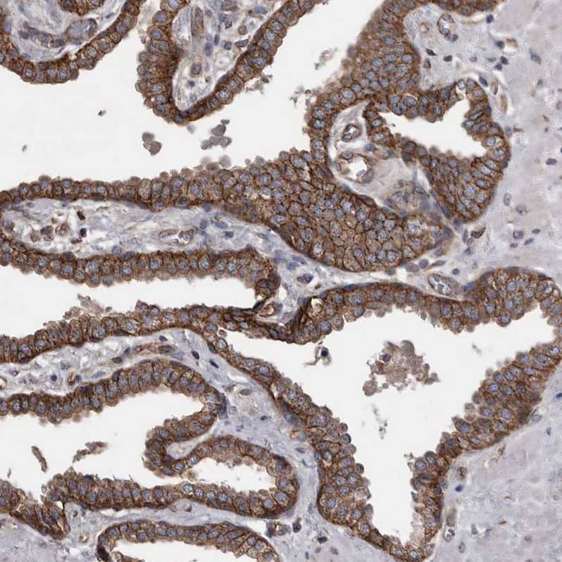 EPLIN Antibody - BSA Free Immunohistochemistry-Paraffin: EPLIN Antibody - BSA Free [NBP1-87947]