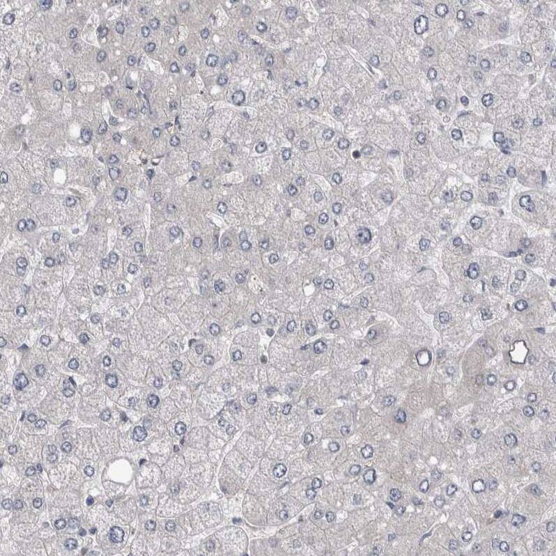 EPLIN Antibody - BSA Free Immunohistochemistry-Paraffin: EPLIN Antibody - BSA Free [NBP1-87947]