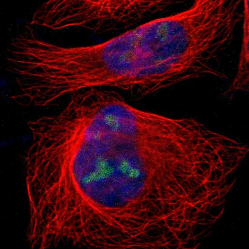 IF3EI Antibody - BSA Free Immunocytochemistry/ Immunofluorescence: IF3EI Antibody - BSA Free [NBP1-87955]
