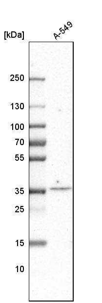 Tsukushi/TSK Antibody - BSA Free Western Blot: Tsukushi/TSK Antibody - BSA Free [NBP1-87959]