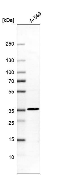DULLARD Antibody - BSA Free Western Blot: DULLARD Antibody - BSA Free [NBP1-87961]