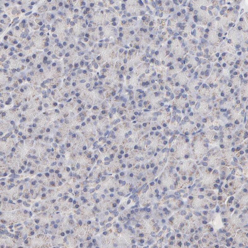 ICT Antibody - BSA Free Immunohistochemistry-Paraffin: ICT Antibody - BSA Free [NBP1-87963]