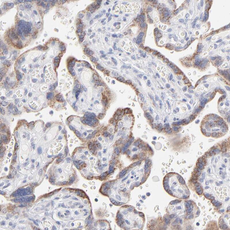 ICT Antibody - BSA Free Immunohistochemistry-Paraffin: ICT Antibody - BSA Free [NBP1-87963]