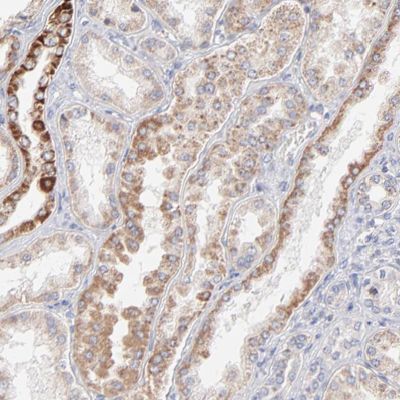 ICT Antibody - BSA Free Immunohistochemistry-Paraffin: ICT Antibody - BSA Free [NBP1-87963]