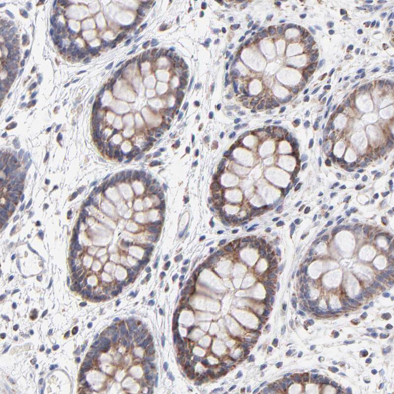 ICT Antibody - BSA Free Immunohistochemistry-Paraffin: ICT Antibody - BSA Free [NBP1-87963]