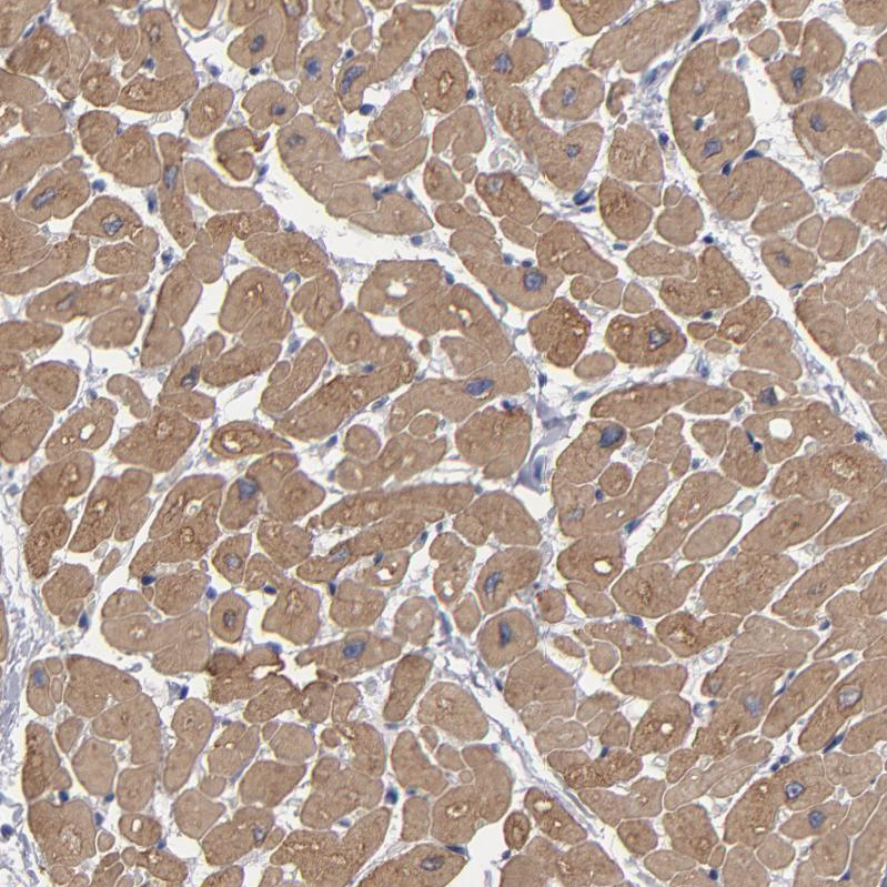 URB/CCD80 Antibody - BSA Free Immunohistochemistry-Paraffin: URB/CCD80 Antibody - BSA Free [NBP1-87965]