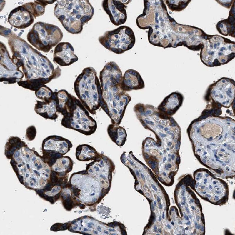 DPH4 Antibody - BSA Free Immunohistochemistry-Paraffin: DPH4 Antibody - BSA Free [NBP1-87969]