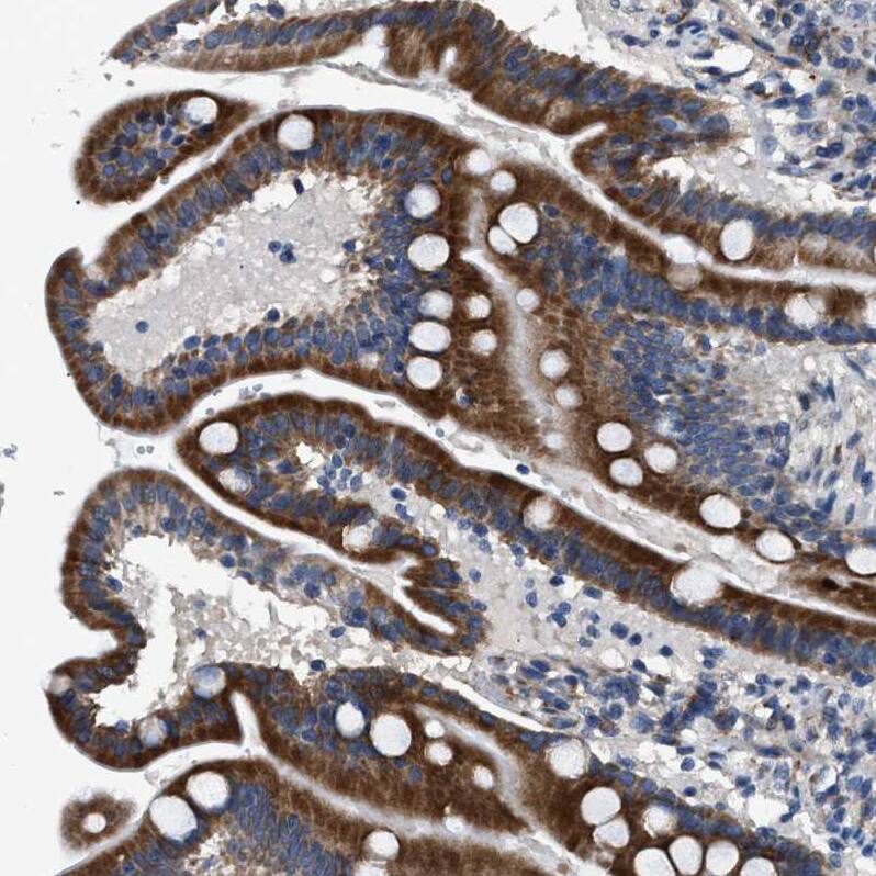 DPH4 Antibody - BSA Free Immunohistochemistry-Paraffin: DPH4 Antibody - BSA Free [NBP1-87969]