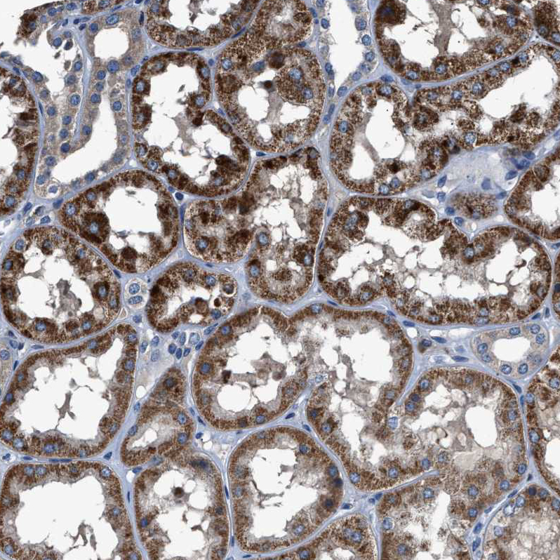 DPH4 Antibody - BSA Free Immunohistochemistry-Paraffin: DPH4 Antibody - BSA Free [NBP1-87969]